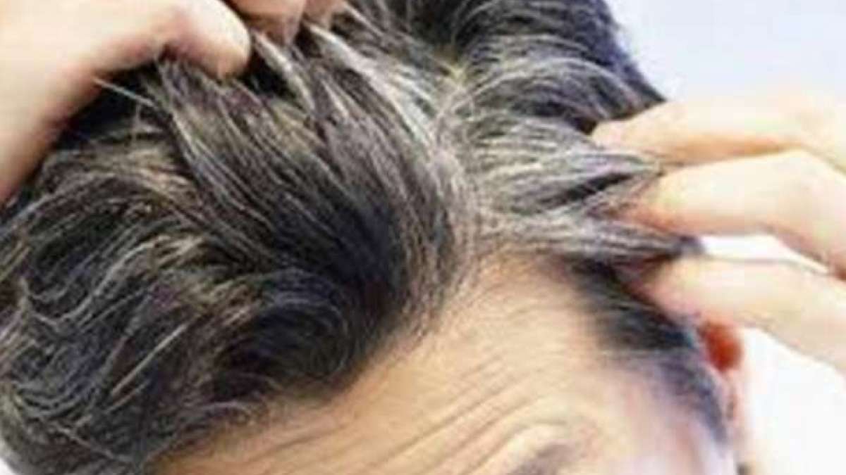 This is what makes your hair go grey: समय से पहले बाल सफेद होने के ये हैं असली कारण, जानकर हो जाएंगे हैरान - India TV Hindi This is what makes your hair go grey: समय से पहले बाल सफेद होने के ये हैं असली कारण, जानकर हो जाएंगे हैरान - India TV Hindi