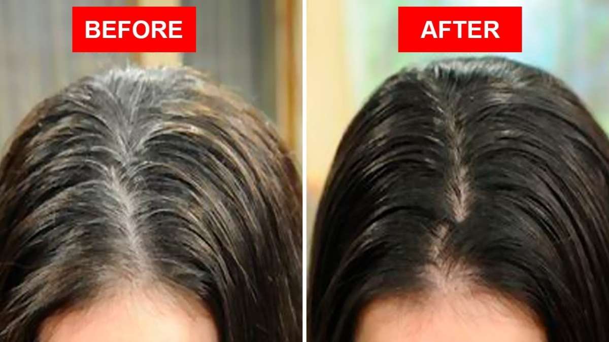 One ingredients can remove all your white hairs grow new hair: बाल धोने से पहले करें इस एक चीज का इस्तेमाल और पाएं सफेद बालों से हमेशा के लिए निजात - India One ingredients can remove all your white hairs grow new hair: बाल धोने से पहले करें इस एक चीज का इस्तेमाल और पाएं सफेद बालों से हमेशा के लिए निजात - India