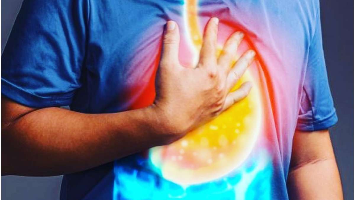 Acidity pain in chest Try these 5 home remedies to get instant relief  naturally in hindi-एसिडिटी के कारण सीने में दर्द से हैं परेशान, ये 5 घरेलू  नुस्खे देंगे राहत - India