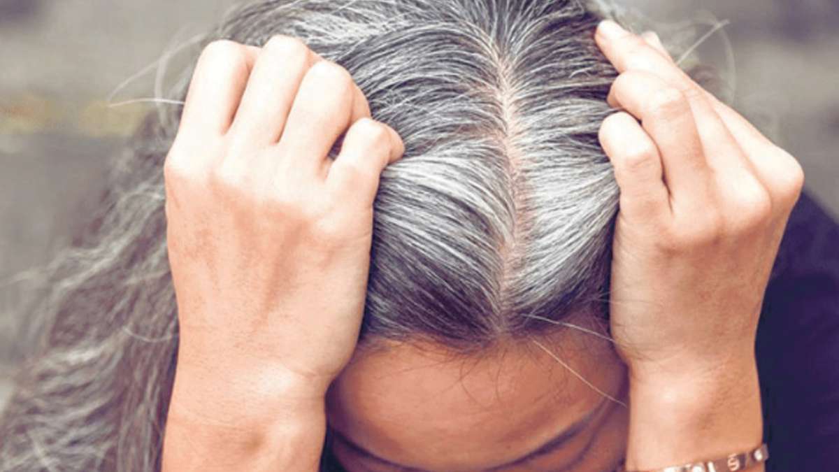 Home remedies for white hair know remedy and yoga poses to get rid grey hair  in to black permanently: कम उम्र में हो गए हैं बाल सफेद तो अपनाएं इन घरेलू  नुस्खों