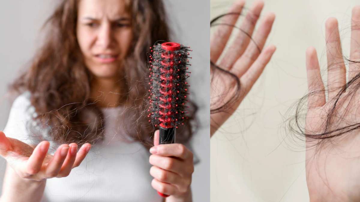 Hair Loss: झड़ते हुए बालों को देखकर सता रहा है गंजे होने का डर? इन नुस्खों  की मदद से पाएं जड़ से मजबूत बाल - India TV Hindi