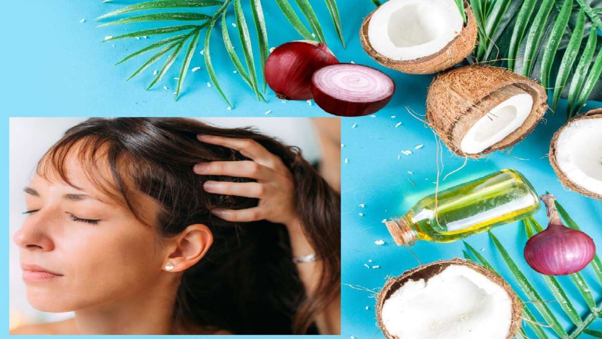 Use coconut oil and onion juice apply to hair remove dandruff problems know  benefits | बालों में लगाएं प्याज का रस और नारियल तेल, डैंड्रफ से मिलेगा  छुटकारा - India TV Hindi