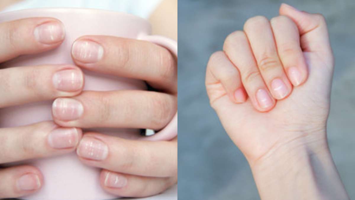 Zinc deficiency causes white spots on nails, these superfoods will remove  this deficiency इस मिनिरल की कमी से होती है नाखून पर सफेद दाग, ये सुपरफूड  करेंगे इस कमी को दूर -
