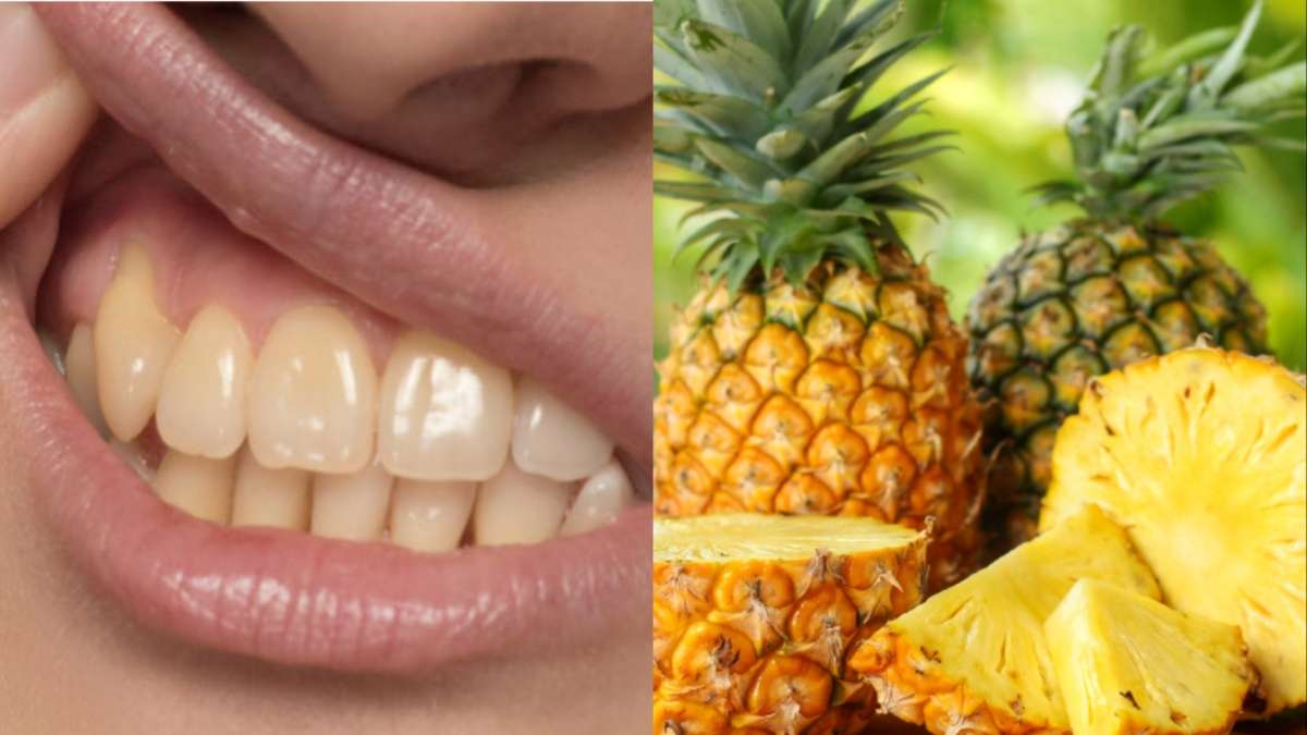 Are your teeth not getting cleaned even after brushing day and night?  Eat these 4 fruits to remove yellowing of teeth - India TV Hindi