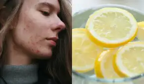 नींबू से लेकर कॉफी तक, स्किन पर इन चीजों का इस्तेमाल करना पड़ सकता है भारी, जानें क्यों?