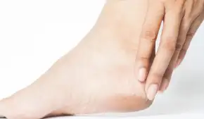 फटी एड़ियों से पाना चाहती हैं छुटकारा, अपनाकर देखें ये घरेलू नुस्खे 