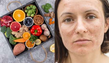 रूखी फटी त्वचा वालों को सर्दियों में जरूर खाने चाहिए ये फल और सब्जियां, डॉक्टर ने बताया नेचुरली ग्लो करने लगेगी