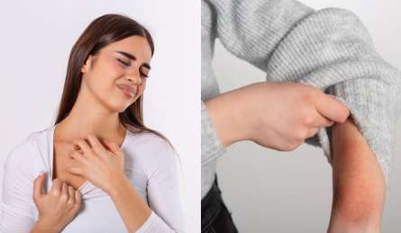 सर्दियों में ऊनी कपड़े पहनने से शरीर पर क्यों होती है खुजली, ये उपाय कर लें तुरंत मिल जाएगी राहत