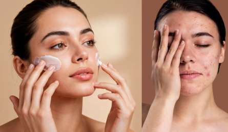 चेहरे पर कच्चा दूध लगाने से क्या होता है, त्वचा से जुड़ी ये समस्याएं हो सकती हैं दूर