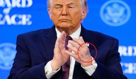 ट्रंप को आखिर बीमारी क्या है? हाथ पर दिखा नीला निशान तो अब राष्ट्रपति ने खुद दे डाली सफाई