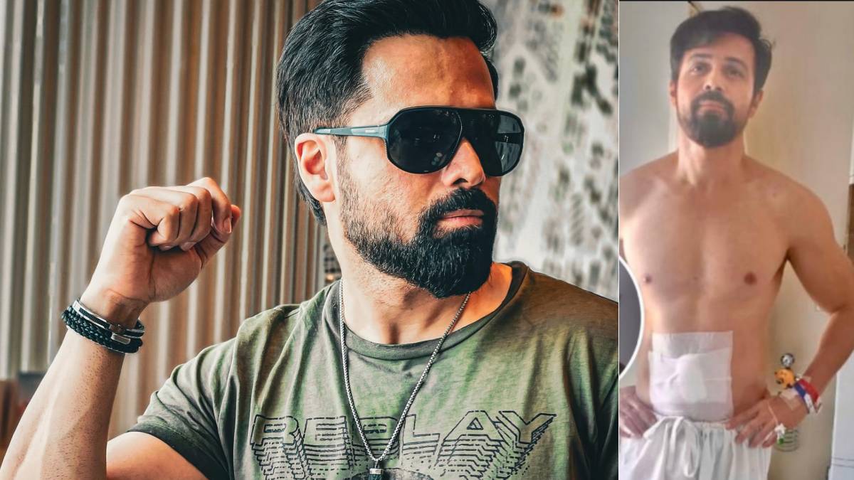 जुनून के आगे चोट भी फेल, शूटिंग के दौरान घायल हुए इमरान हाशमी, अस्पताल से वायरल हुईं तस्वीरें