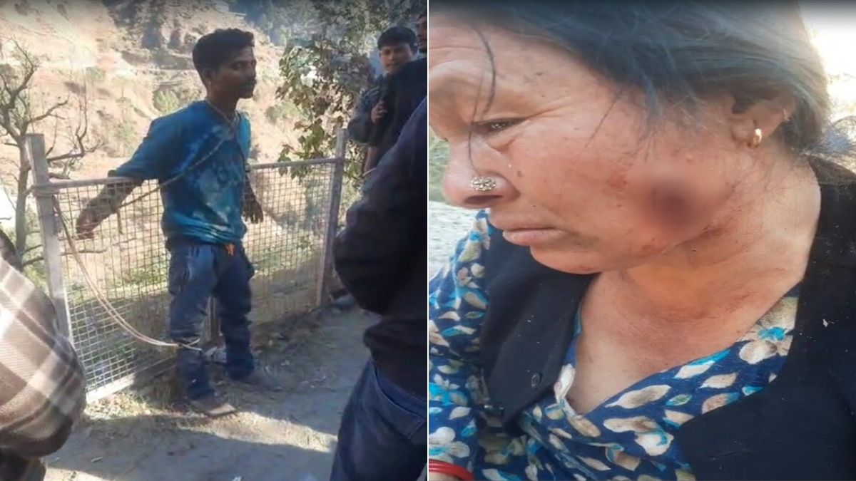 VIDEO: शिमला में नेपाली व्यक्ति ने महिला से आभूषण छीने, चेहरे पर दांतों से काटा; हालत देख लोगों की रूह कांप उठी