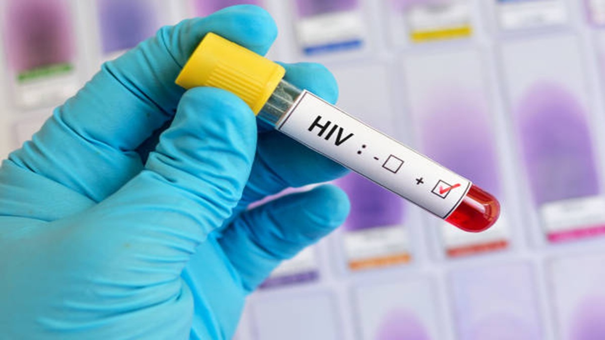 पाकिस्तान में HIV का भयानक प्रकोप! कराची के अस्पताल में 6 बच्चों की जान गई, 94 संक्रमित