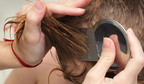 Lice Remedies: सिर से जुएं भगाने के लिए अपनाएं ये घरेलू उपाय/easy home  remedies to get rid from lice treatment juye bhagane ke gharelu upay -  India TV Hindi