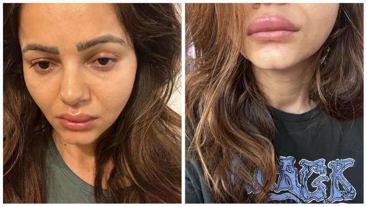 रुबीना दिलैक के चेहरे का हुआ बुरा हाल, एक्ट्रेस ने खुद सुनाई आपबीती