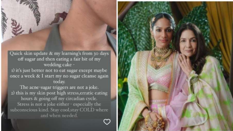  how to get rid of acne in 1 month by Masaba gupta