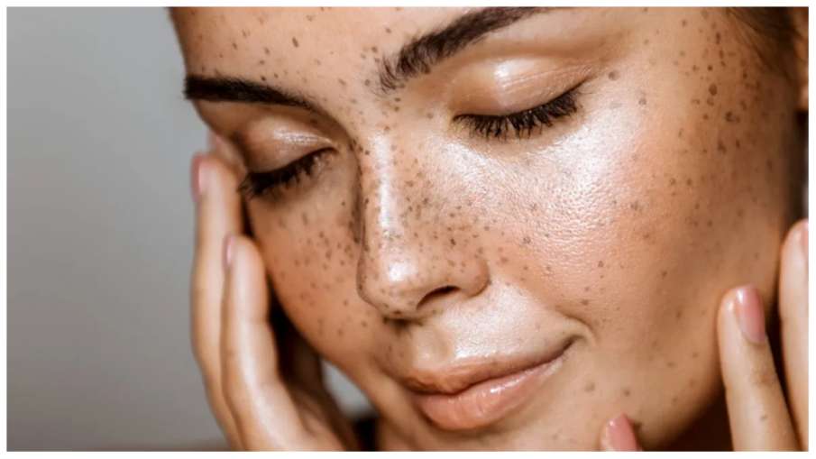  coconut water benefits for skin