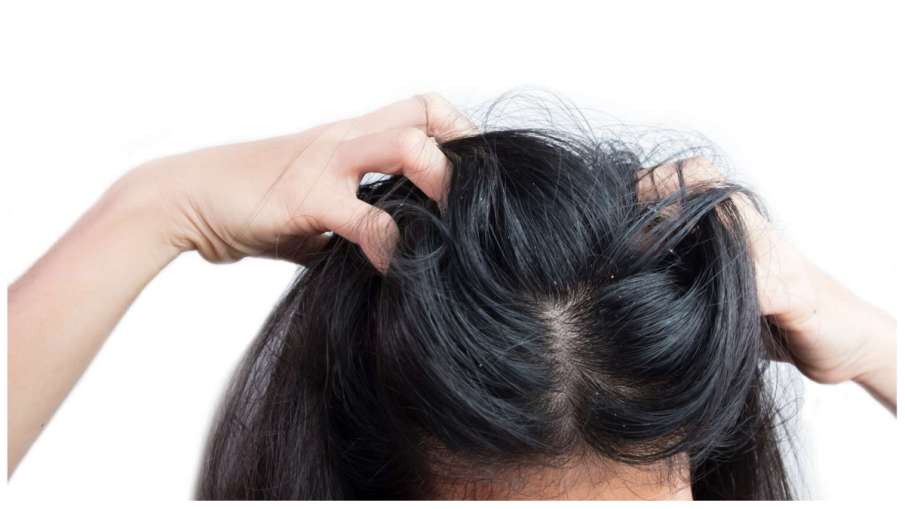 scalp_infection