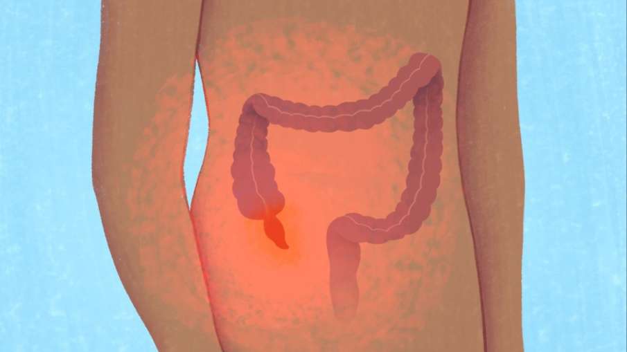 causes_of_appendix_pain