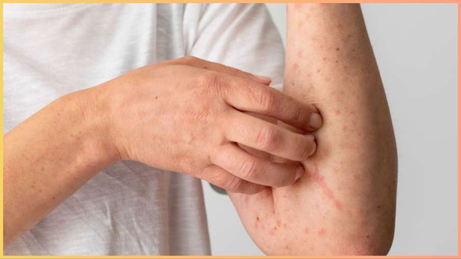 बरसात में स्किन की कई समस्याओं का हल है नीम और कपूर | Camphor and neem for  skin diseases in rainy season in hindi - India TV Hindi