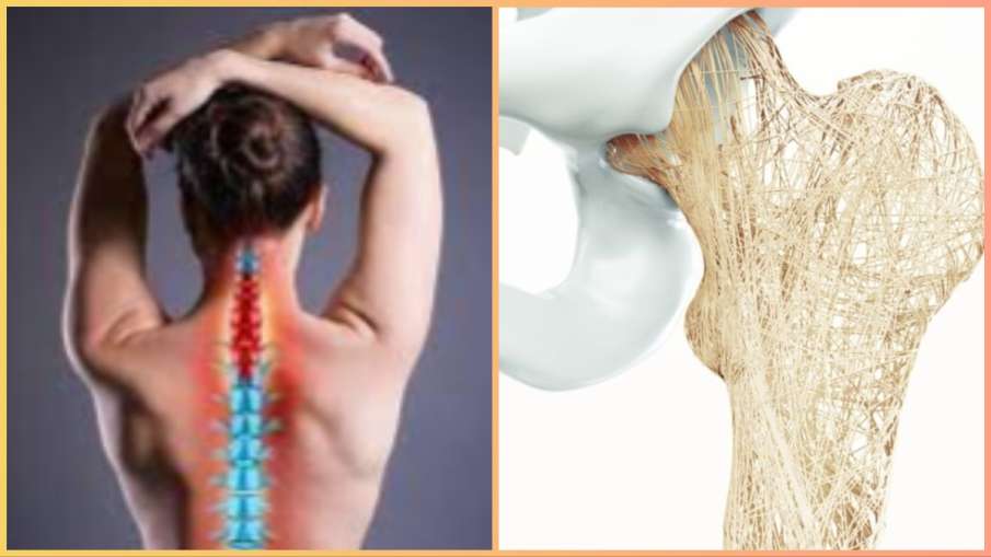 osteoporosis causes