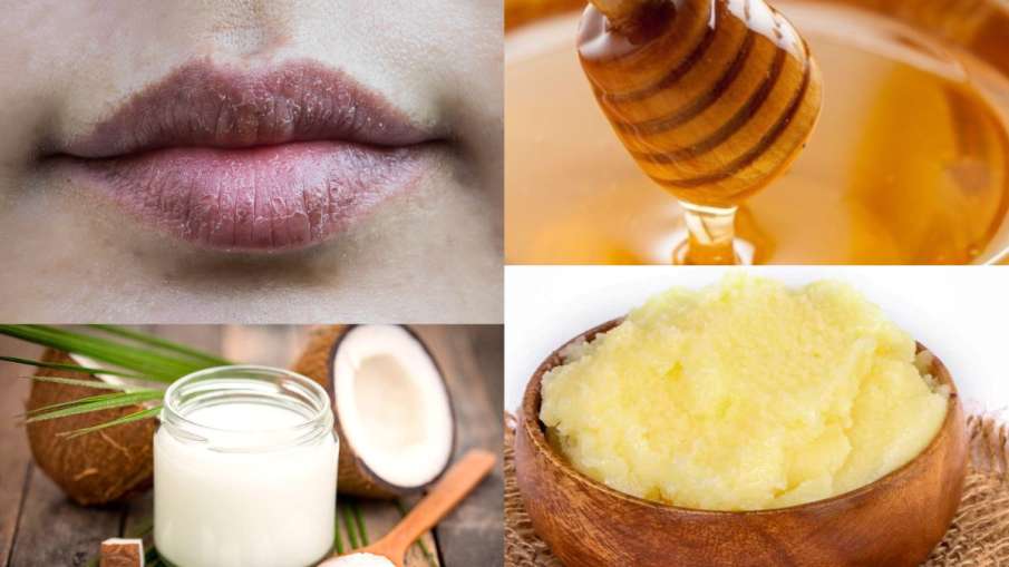  Home remedies for dry lips