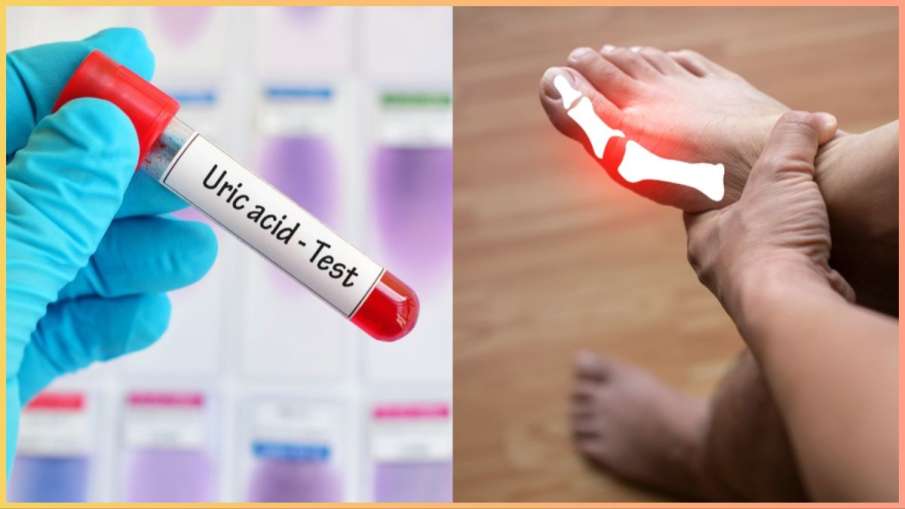 uric acid