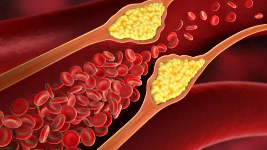 radish for high cholesterol