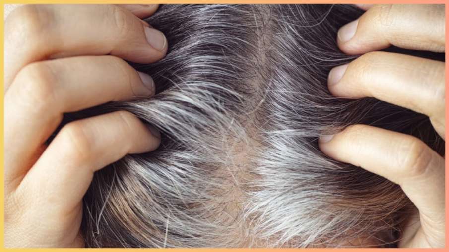  grey hair reversal remedy