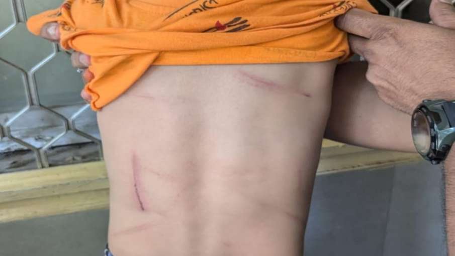 मासूम बच्चे पर अत्याचार की तस्वीर