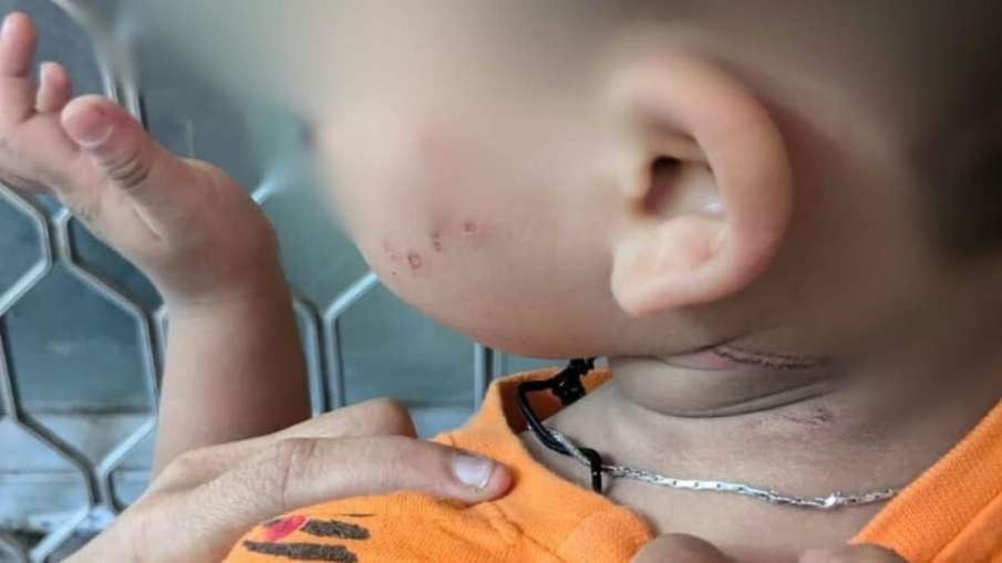 मासूम बच्चे पर अत्याचार की तस्वीर