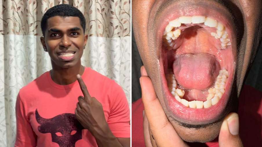 man with most teeth in the world, Prathab Muniandy record, Guinness World Records teeth