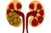 kidney- India TV Hindi