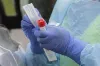 386 new cases of coronavirus reported in Pakistan- India TV Hindi