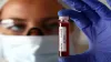 coronavirus cases in Bhopal- India TV Hindi