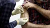 HIV surge in UP's Unnao caused by unsafe injection exposure: ICMR- India TV Hindi