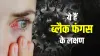 black fungal infection- India TV Hindi
