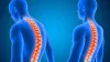 spinal cord- India TV Hindi