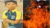 Father burns 12-year-old son to death - India TV Hindi