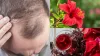 Hibiscus flower For Hair - India TV Hindi