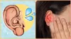 What happens if water goes in your ear during a bath- India TV Hindi