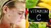 Vitamin C Deficiency- India TV Hindi