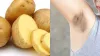 Potato juice for underarms- India TV Hindi