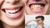 Home Remedies For Yellow Teeth Whitening- India TV Hindi