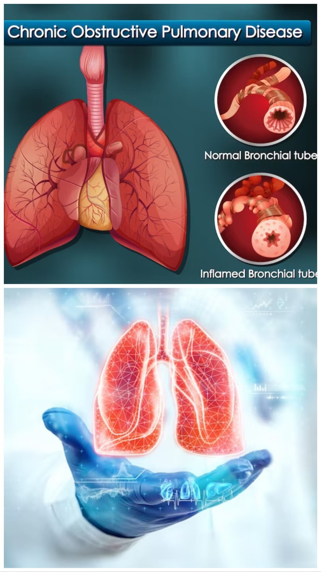 COPD में खाएं ये 5 सुपरफूड्स