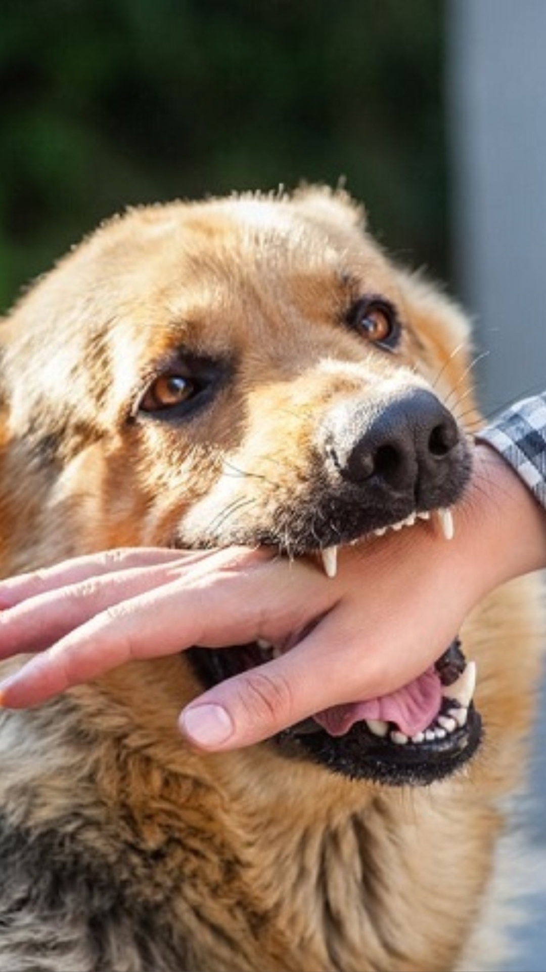 World Rabies Day: कुत्ता काटने के बाद दिखें ये लक्षण तो, समझ लें हो गया रेबीज