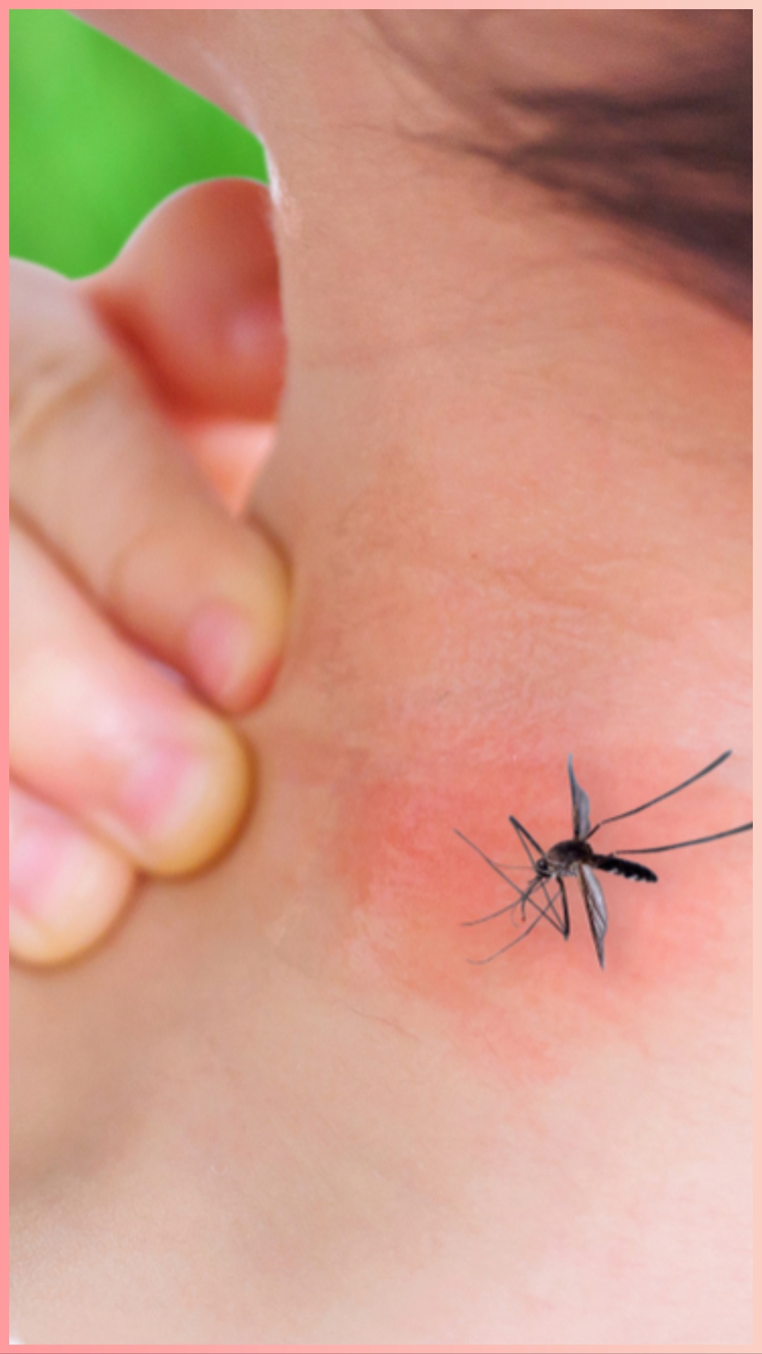 डेंगू के बढ़ते प्रकोप के बीच मानें CDC की ये 10 बातें