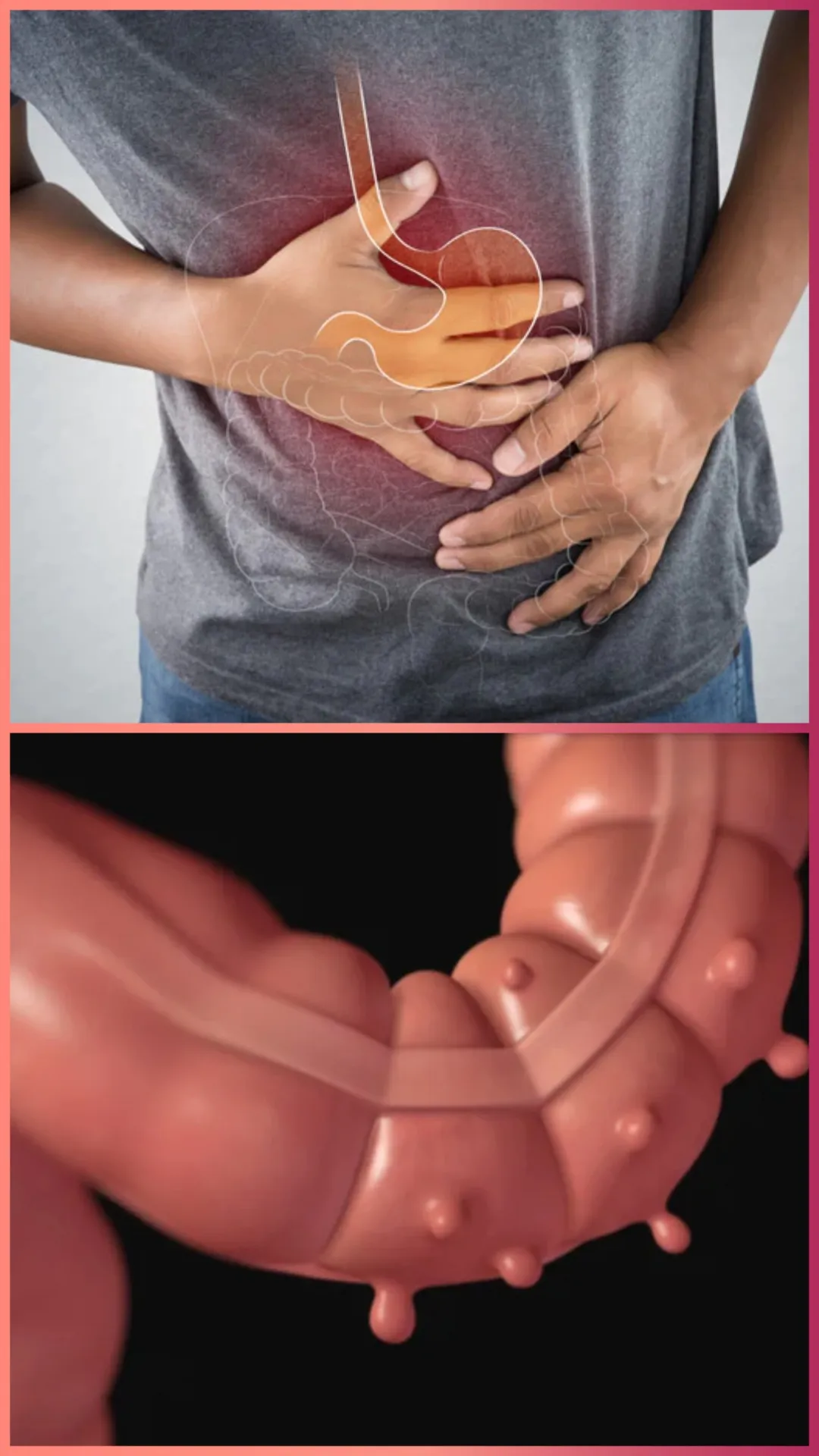 पेट में ज्यादा गैस बनने से कौन सी बीमारी होती है?