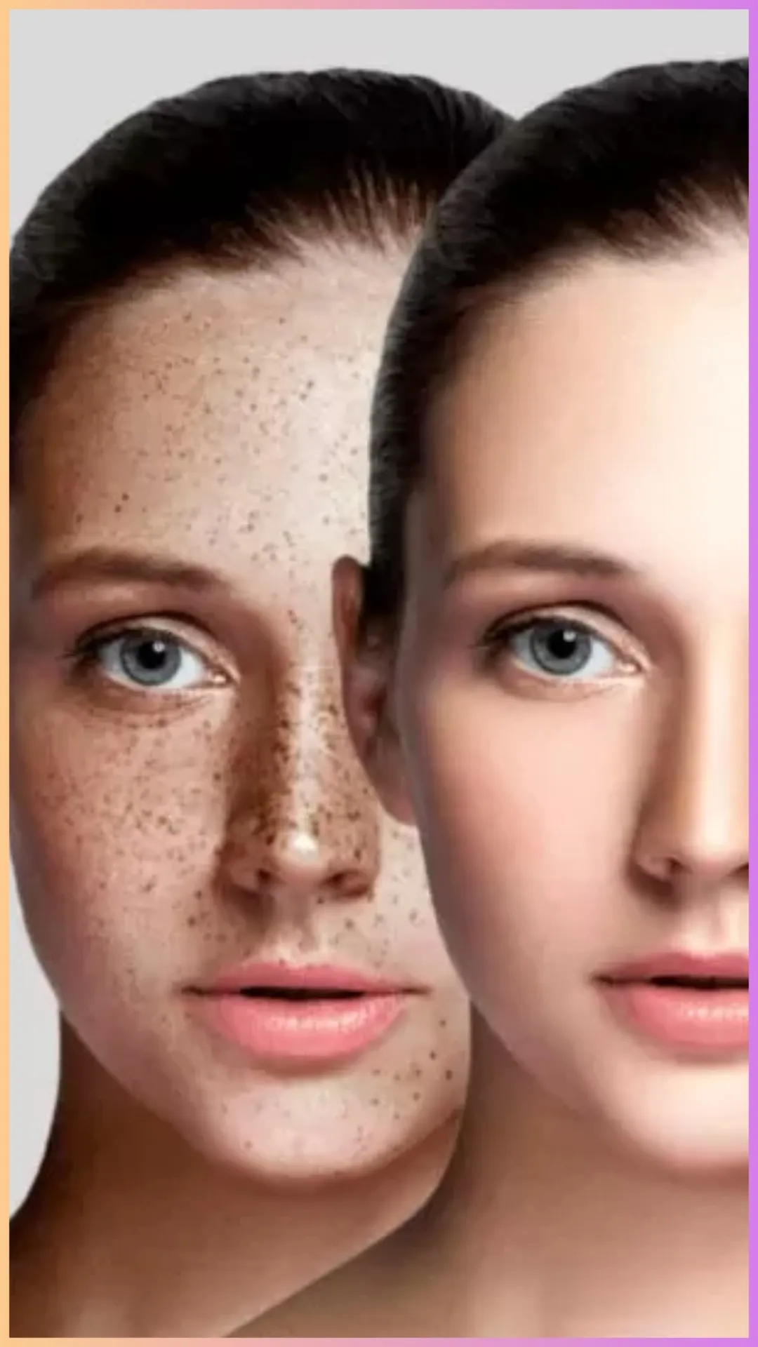 पिगमेंटेशन किसकी कमी से होता है?