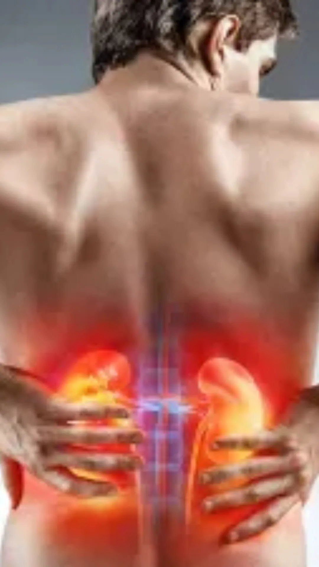 किडनी स्टोन होने पर क्या नहीं खाना चाहिए?